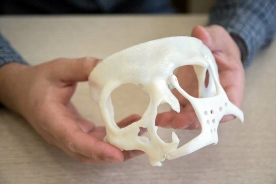 Эндопротез, созданный с помощью 3d принтера Эндопротез, созданный с помощью 3d принтера