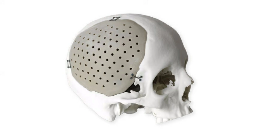 Модель реек в медицине Модель реек в медицине